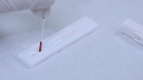 Hiv-test-equipment-on-table.-Test-blood-analyzer.-Blood-test-hiv
