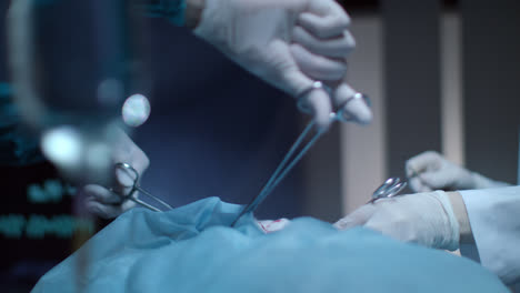 Chirurgischer-Eingriff.-Chirurgische-Hand-Mit-Medizinischem-Werkzeug.-Chirurgen-Operieren