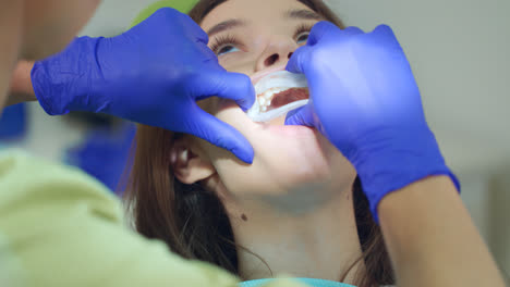 Dentista-Preparando-La-Cavidad-Bucal-Del-Paciente-Para-El-Procedimiento-De-Blanqueamiento-Dental