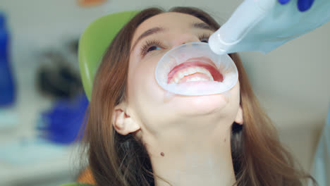 Patient-Beim-Zahnaufhellungsverfahren-In-Der-Zahnklinik.-Arzt-Macht-Licht-An
