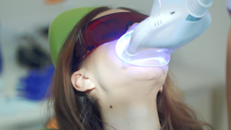 Close-up-woman-at-teeth-whitening-procedure-in-dental-office