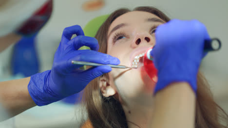 Patientin-Bei-Zahnärztlicher-Behandlung.-Zahnarztarbeit-Mit-Zahnärztlicher-Polymerisationslampe