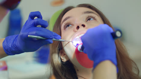 Aufhellung-Von-Zahnfüllungsmaterial.-Nahaufnahme-Eines-Zahnarztes,-Der-Den-Eingriff-Durchführt