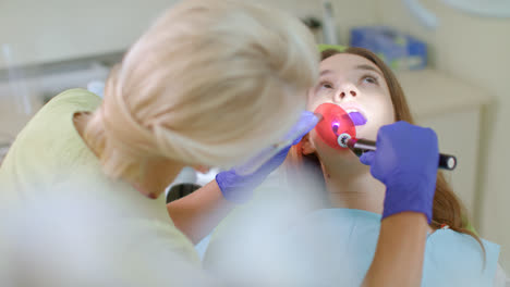 Zahnarzt-Arbeitet-Mit-Einer-Zahnpolymerisationslampe-In-Der-Mundhöhle.-Zahnbehandlung