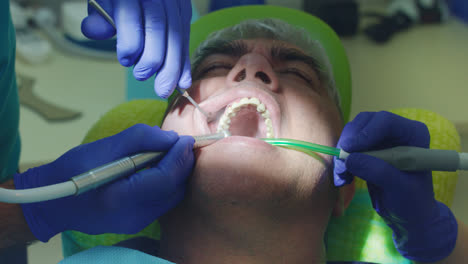 Zahnarzt-Heilt-Männlichen-Patienten-In-Der-Stomatologie.-Nahaufnahme-Der-Hände-Des-Zahnarztes-Bei-Der-Arbeit