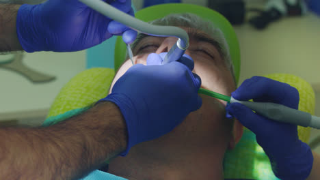 Root-canal-treatment-process.-Doctor-hands-drilling-teeth